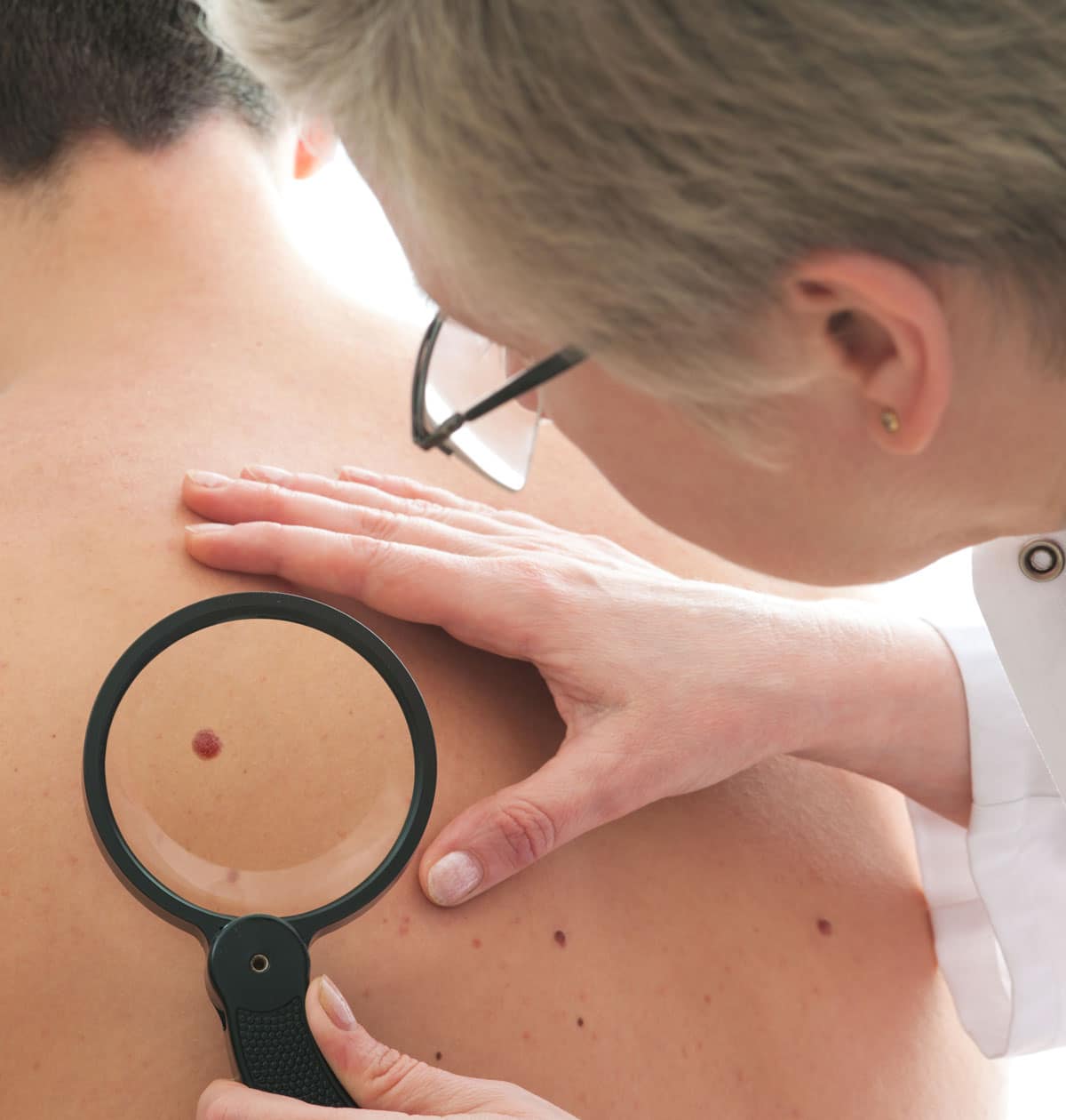 Skin Cancer Inspection