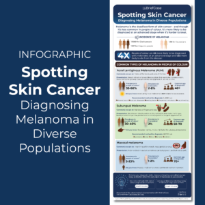 Diagnosing melanoma in diverse populations infographic.